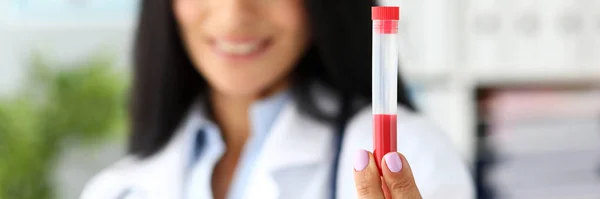 Médico fêmea mão segurando tubo de ensaio de plástico contendo líquido vermelho — Fotografia de Stock