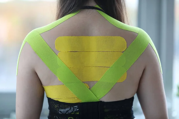 Female wearing kinesio tapes at her back and shoulders at doctor office — 스톡 사진