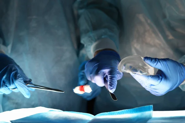 Cirurgia de implantes mamários, cirurgião e trabalho prático . — Fotografia de Stock