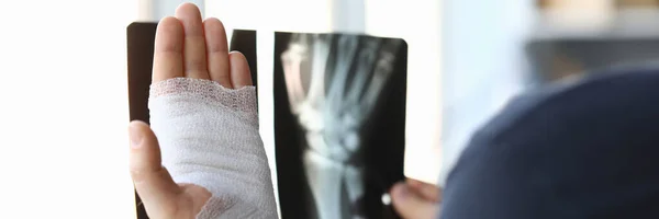 Férfi bekötözött kéz tartja röntgen kép közelkép — Stock Fotó
