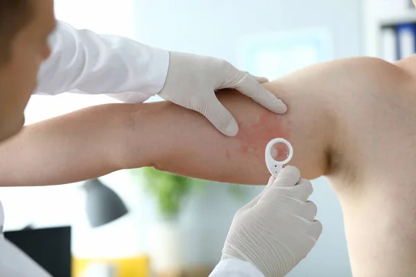 Dermatólogo masculino examina erupción en paciente de la pierna — Foto de Stock