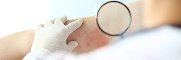 Ruce v rukavicích s profesionálním dermatologem — Stock fotografie