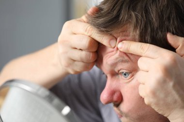 Yüzüne bakan adam.