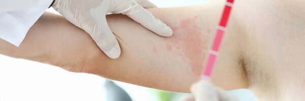 Choosing skin treatment method concept