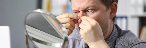 Man thuis knijpt vingers acne in de spiegel — Stockfoto