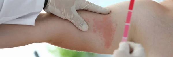 Médico en guantes protectores —  Fotos de Stock