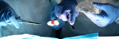 Göğüs implantı ameliyatı, cerrah ve becerikli çalışma..