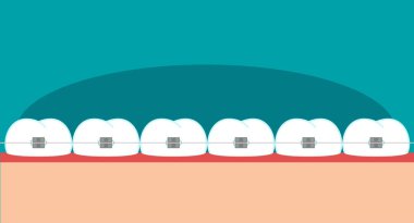 diş diş telleri düz görüntü