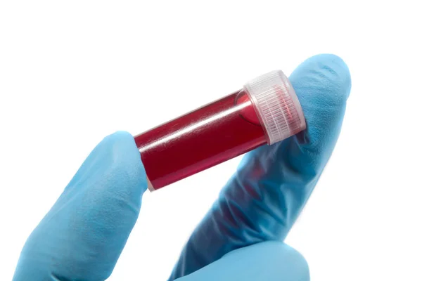 Трубка для анализа крови в руке врача , — стоковое фото