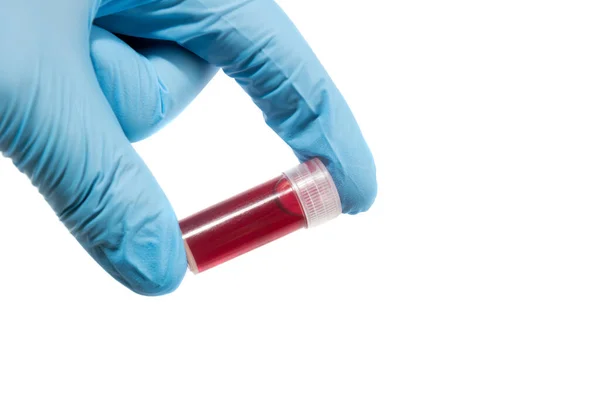 Трубка для анализа крови в руке врача , — стоковое фото