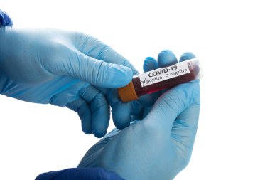 Doktor elinde kan testi tüpü var.,
