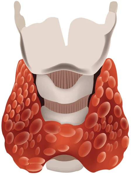 Орган щитовидной железы человеческого тела — стоковый вектор