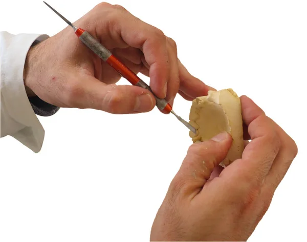 Spezialhände, die eine Gips-Prothese formen — Stockfoto