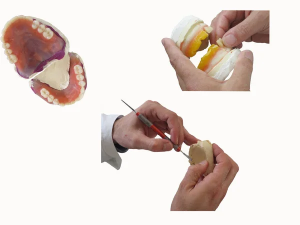 Mãos especializadas que moldam uma dentadura de gesso — Fotografia de Stock