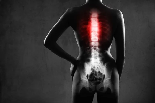 Colonna vertebrale umana a raggi X, su sfondo grigio. — Foto Stock