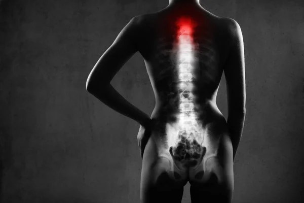 Menschliche Wirbelsäule im Röntgenbild, auf grauem Hintergrund. — Stockfoto