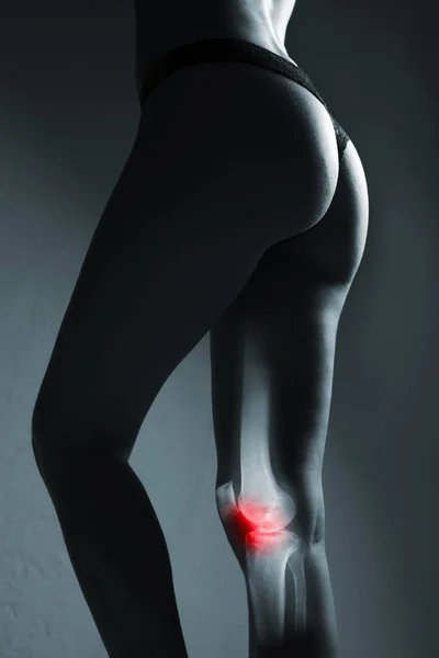 Articulación de rodilla humana y pierna en rayos X, sobre fondo gris — Foto de Stock