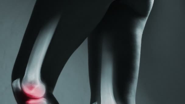 Human knee joint and leg in x-ray, on gray background — Stock Video