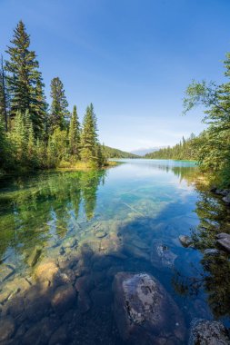 Turkuaz Gölü, Beş Göller Vadisi, Jasper Ulusal Parkı, arka dağlar, Alberta, Kanada