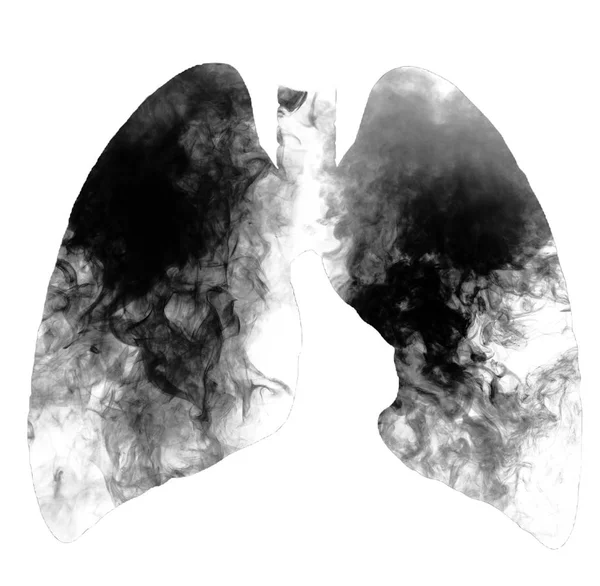 Πνεύμονες καπνιστή που απομονώνονται σε λευκό φόντο με αντίγραφο χώρου. Το κάπνισμα σκοτώνει, έννοια με το τσιγάρο και ο καπνός. Καμία έννοια το κάπνισμα με τσιγάρα και καπνό — Φωτογραφία Αρχείου