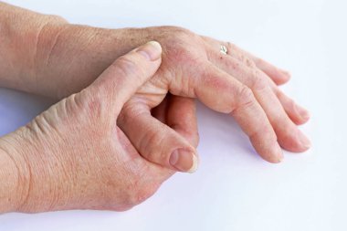 Yaşlı bir kadın ağrı onun elinde vardır.
