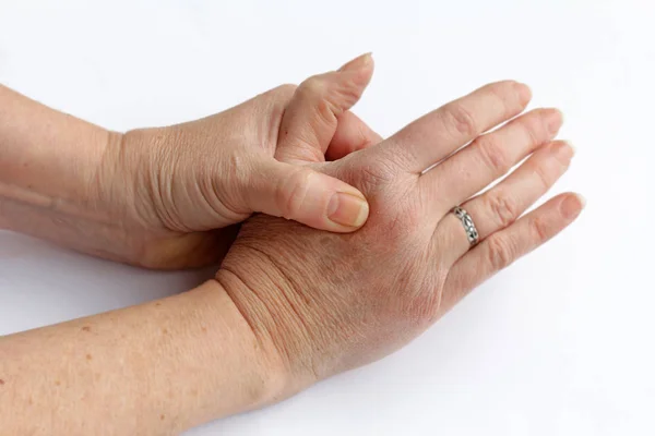 Yaşlı bir kadın ağrı onun elinde vardır. — Stok fotoğraf