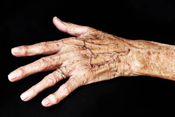 La mano de una anciana — Foto de Stock