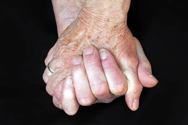 Руки двох старих жінок — стокове фото
