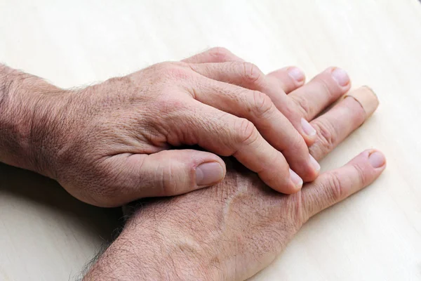 An elderly man has pain in his fingers and hands — Stock Photo, Image