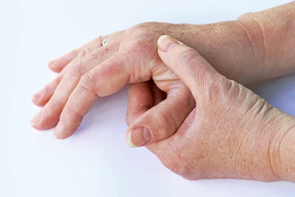 Μια ηλικιωμένη γυναίκα έχει τον πόνο στα χέρια της — Φωτογραφία Αρχείου