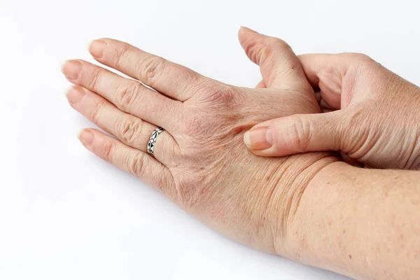 Uma Mulher Mais Velha Tem Dor Nas Mãos Senior Com — Fotografia de Stock