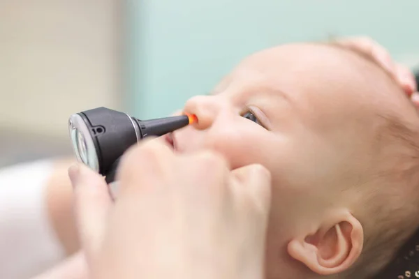 Säugling in Kinderklinik. Nahaufnahme der Hand des Arztes mit modernem Otoskop, das die Nase des Babys untersucht. Kindergesundheit und Prävention von Krankheiten — Stockfoto