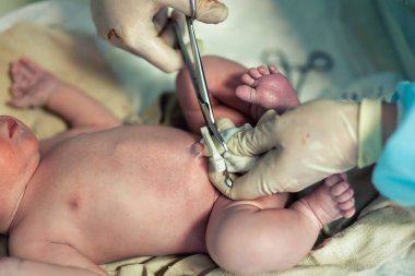 Doktor Doğum Uzmanı, yeni doğmuş bebeğe, göbek bağını makasla kesiyor. Çocuk doğuran bir tıp cerrahı. Yeni insan hayatı başlıyor. Doğum hastanesi.