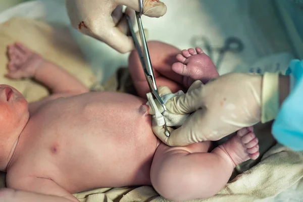 Close-up doctor obstetrician nurse cutting umbilical cord with medical scissors to newborn infant baby. Medical surgeon giving birth to child. New human life begin. delivery labor childbirth hospital.