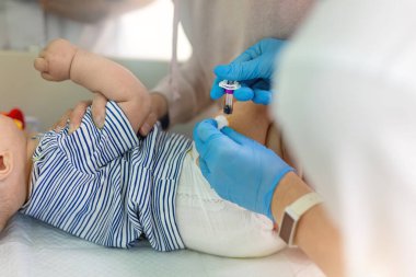Hemşire, kaslar arası hastalıklara ve virüs enfeksiyonuna karşı rutin bir aşı yapıyor. Lastik eldivenli doktor bebek bacağına şırınga yapıyor. Çocuk sağlığı ve hastalık önleme.