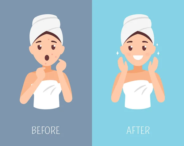 女人的皮肤护理。之前和之后的脸治疗。面部皮肤问题平插图 — 图库矢量图片
