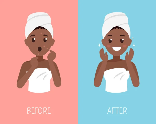 Black woman skin care. Before and after face treatment. Facial skin problems flat illustration — Stock Vector