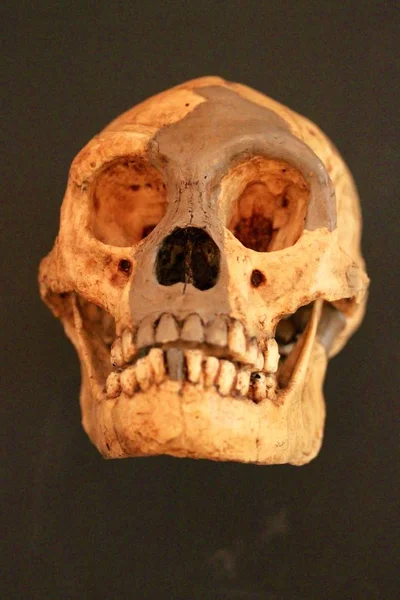 Old Human Skull Black Background — Stock Photo, Image