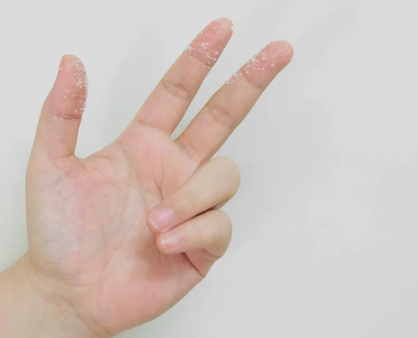 Άνοιγμα Κενό Χέρι Φτάνει Λευκή Ζάχαρη Στα Δάχτυλα Ενάντια Λευκό — Φωτογραφία Αρχείου