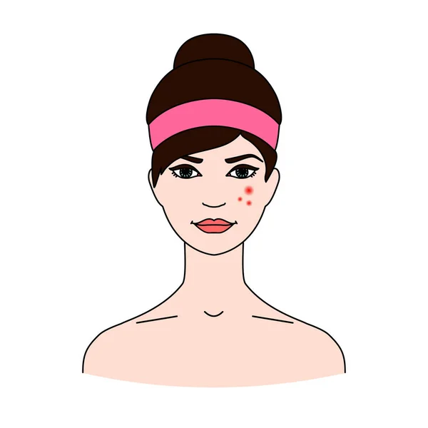 Kvinnans ansikte med akne. Begreppet hälsa hudproblem. Dermatologiska sjukdomar. — Stock vektor