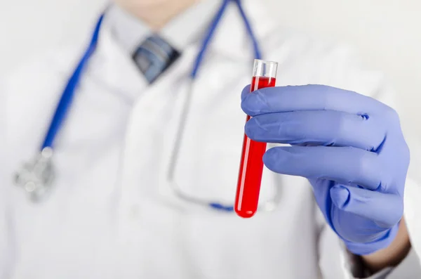 Doctor holds a tube of red fluid — Stock Photo, Image