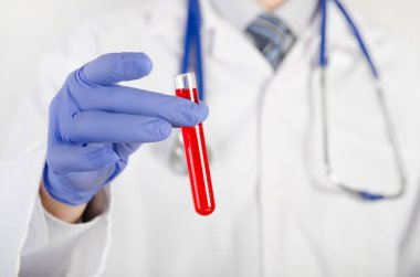 Doktor bir tüp kırmızı sıvı tutar