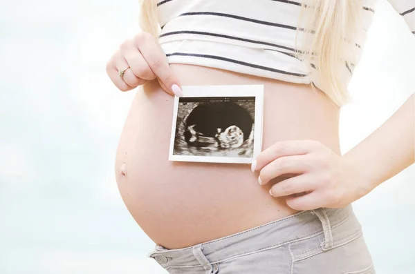 Mujer embarazada sosteniendo ultrasonido exploración en su vientre — Foto de Stock