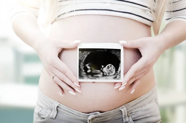 Mujer embarazada sosteniendo ultrasonido exploración en su vientre — Foto de Stock