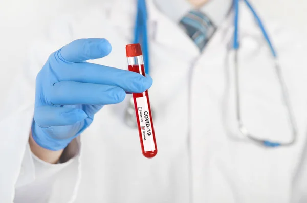 Doctor Holds Test Tube Blood Test Positive Corona Virus Test — Stock Photo, Image