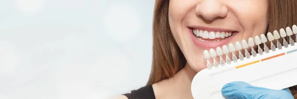 Teeth Whitening Proces Set Implantaten Met Verschillende Tinten Van Toon — Stockfoto