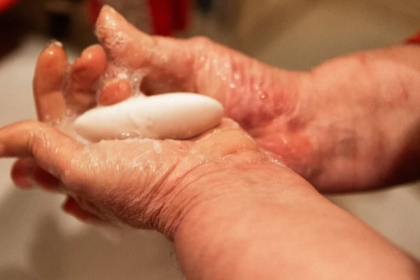 Mujer Lava Las Manos Bajo Chorro Agua Jabón Concepto Covid19 —  Fotos de Stock