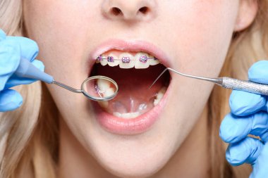 Ayna ve periodontal sonda kullanarak diş hekimi