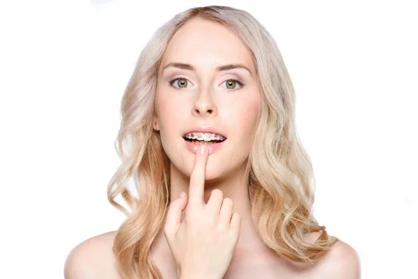 Frau zeigt auf Zähne mit Zahnspange — Stockfoto