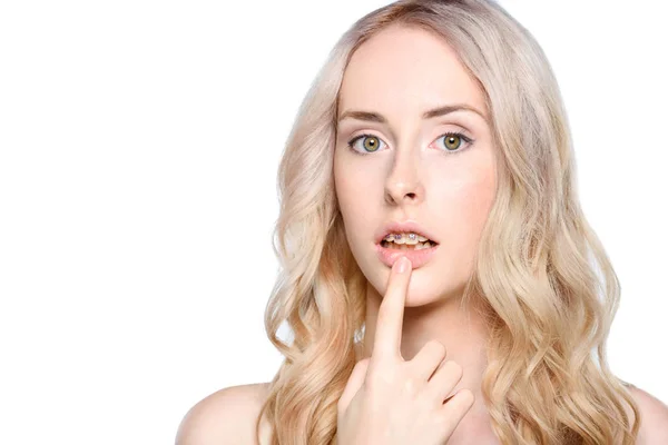 Woman pointing to teeth with braces — Stock Photo, Image